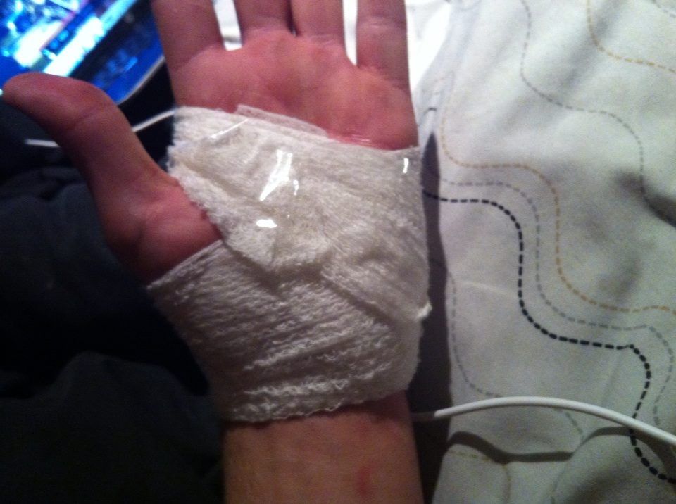 bandaged hand.jpg