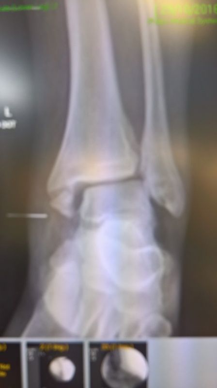WP_20161103_15_20_06_Rich.jpg